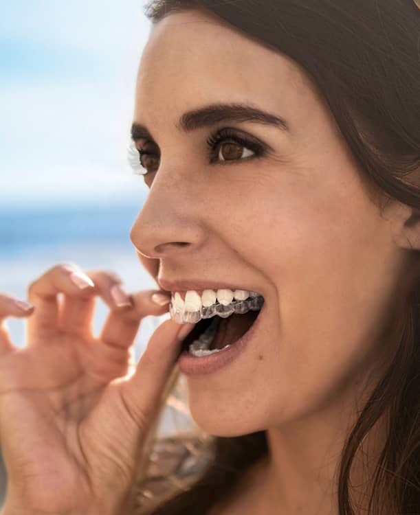 treatment1 invisalign