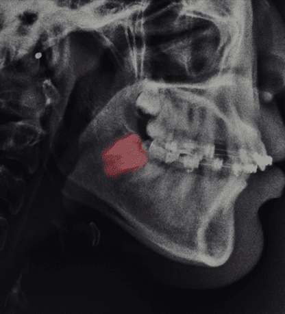 Treatment - Cosmetic & Family Dentistry